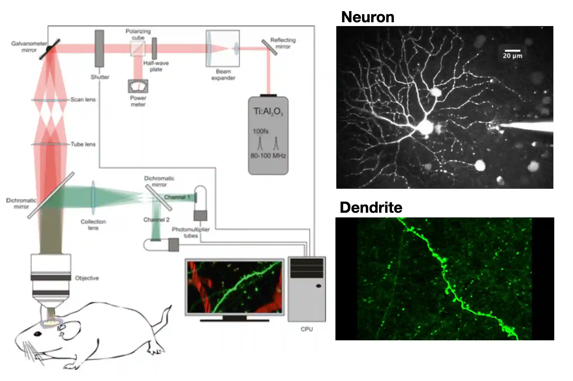 Neural Imaging-20250810215619984
